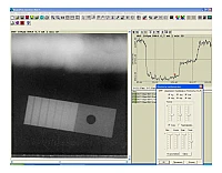 Комплекс цифровой радиографии «Градиент»